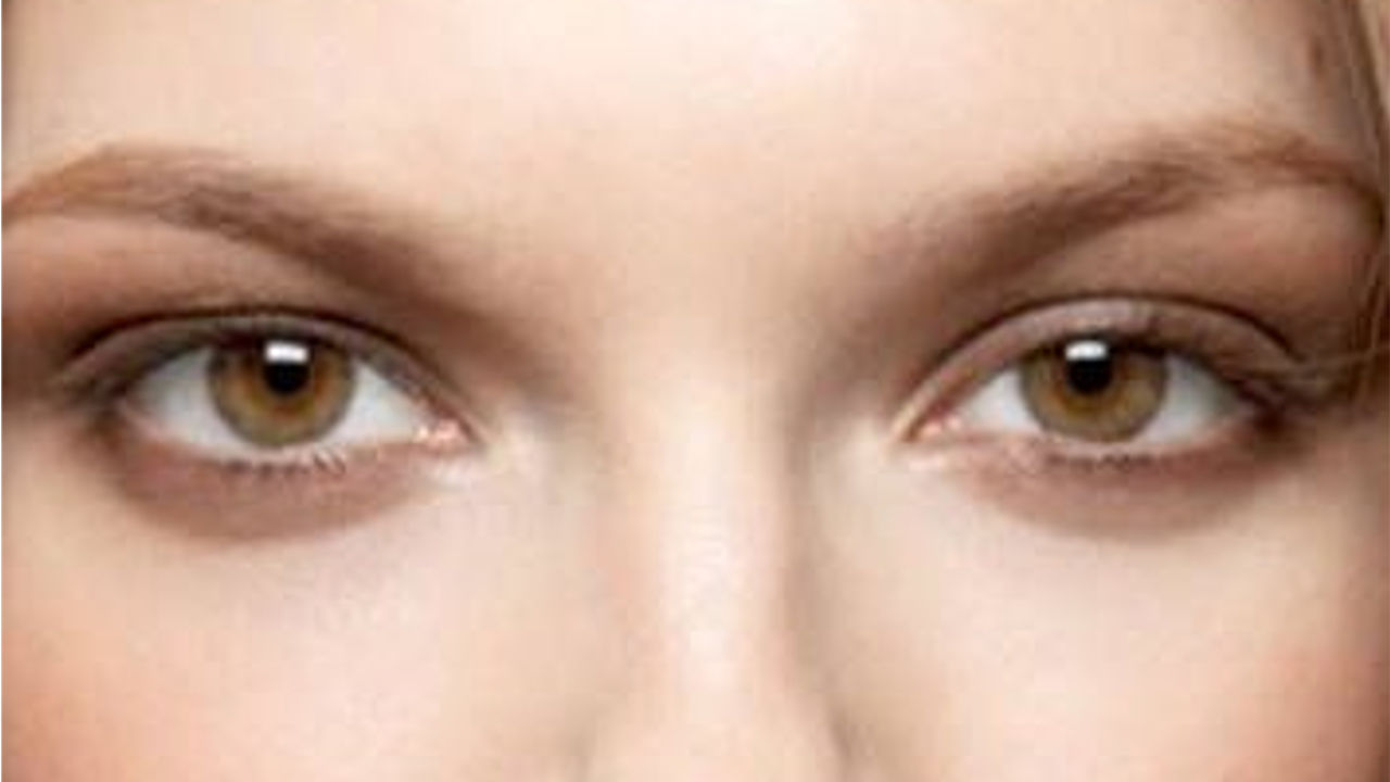 Eye Lift Cream